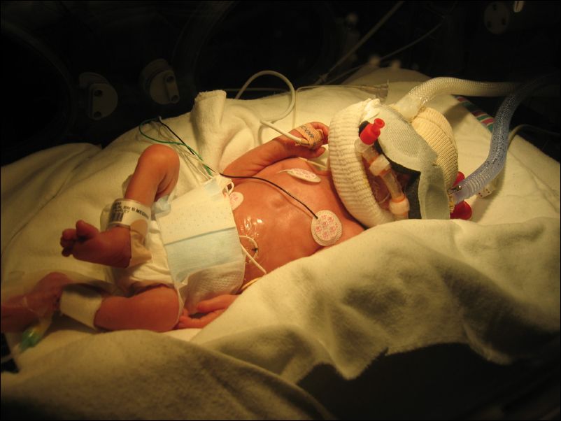 Sebastian off the respirator, on CPAP, he's in there somewhere